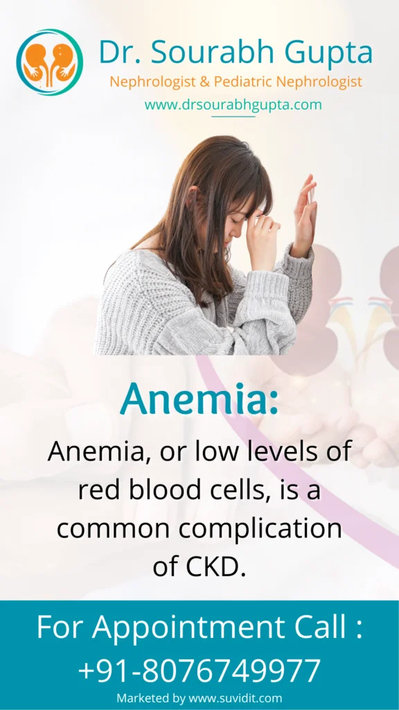 Anemia, or low levels of red blood cells, is a common complication of CKD.